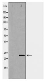 FGF10 Antibody