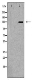 GRIK2 Antibody