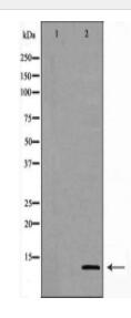 GHRH Antibody