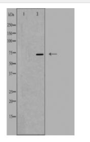 FZD10 Antibody