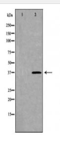 CTSB Antibody