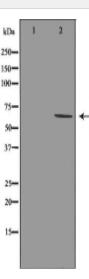 GRK1 Antibody