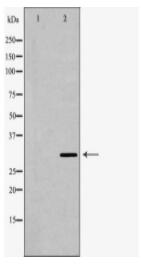 DCN Antibody