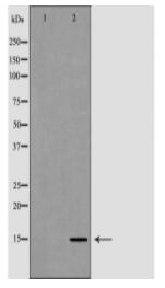 Histone H3R17me2a Antibody