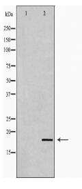 IL2 Antibody
