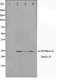 RPL10 Antibody