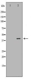 NR1I3 Antibody