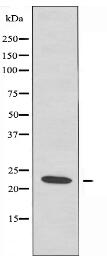 SAR1B Antibody