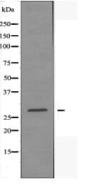 MBL2 Antibody