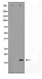 p14 ARF Antibody