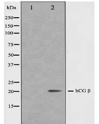 hCG beta Antibody