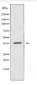 P2RY13 Antibody