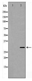 PSMB4 Antibody