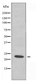 RPS5 Antibody