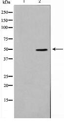 TNF-R2 Antibody