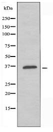 OR52E2 Antibody