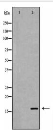 SOD1 Antibody