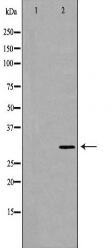 TOLLIP Antibody