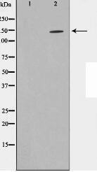 PKCB1 Antibody