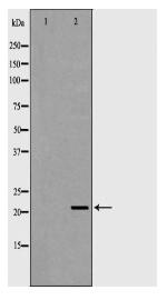 RAC2 Antibody