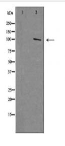 MTTP Antibody