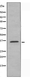 OR52E5 Antibody