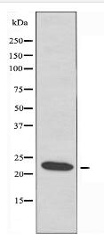 TCTP Antibody