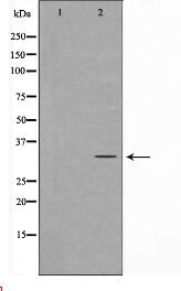 Neuro D Antibody