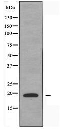 TNFSF15 Antibody