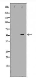 MMP3 Antibody