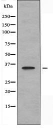 OR6T1 Antibody