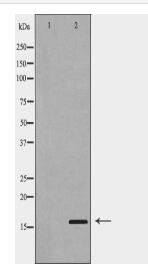 PLA2G2A Antibody