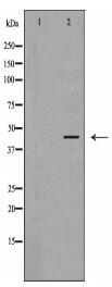 PRKAR1A Antibody