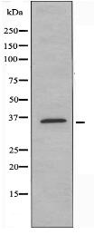 OR5M1/5M10 Antibody