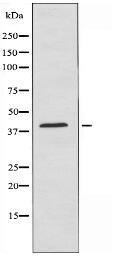 US28 Antibody