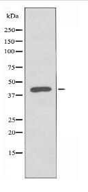 ZDHHC2 Antibody