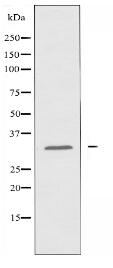 OR10T2 Antibody