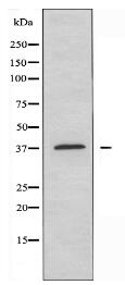 PRKAG1/2/3 Antibody
