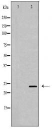 TIMP2 Antibody