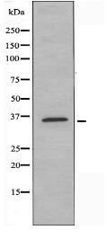 OR52N1 Antibody