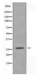 HOXC6 Antibody