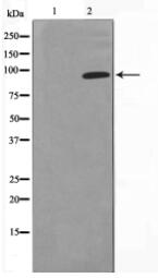 GR Antibody