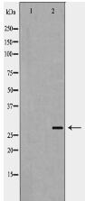 VEGF Antibody