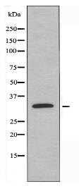 IL15RA Antibody