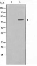 Nibrin Antibody