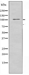 IARS2 Antibody