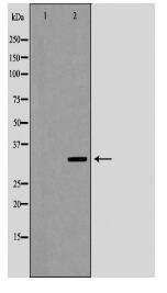 UCP3 Antibody