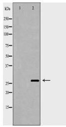 TNFRSF10C Antibody