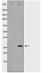 IL27 Antibody