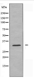 RPS4X Antibody